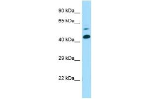 Host: Rabbit Target Name: Ctns Sample Type: Mouse Lung lysates Antibody Dilution: 1. (CTNS antibody  (Middle Region))