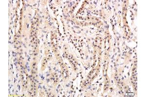 Formalin-fixed and paraffin embedded rat kidney labeled with Anti-phospho-AQP2(Ser269) Polyclonal Antibody, Unconjugated  followed by conjugation to the secondary antibody and DAB staining (AQP2 antibody  (pSer269))
