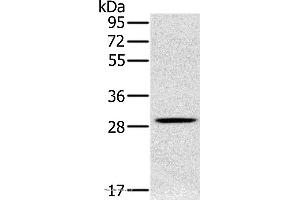 Western blot analysis of Human testis tissue, using CLIC1 Polyclonal Antibody at dilution of 1:400 (CLIC1 antibody)