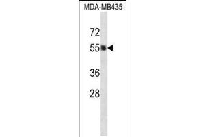 Western blot analysis in MDA-MB435 cell line lysates (35ug/lane). (PIGA antibody  (C-Term))