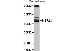 Western blot analysis of extracts of mouse brain, using MEF2C antibody. (MEF2C antibody)