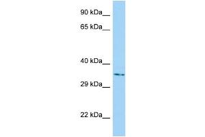 Host: Rabbit Target Name: NUBPL Sample Type: A549 Whole Cell lysates Antibody Dilution: 1.