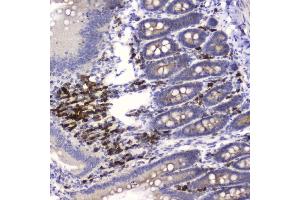 IHC analysis of HE4 using anti-HE4 antibody (ABIN5693137). (WFDC2 antibody  (AA 31-124))