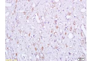 Formalin-fixed and paraffin embedded rat brain labeled with Rabbit Anti Sigma1R/OPRS1/Sigma Receptor Polyclonal Antibody, Unconjugated (ABIN709841) at 1:200 followed by conjugation to the secondary antibody and DAB staining (SIGMAR1 antibody  (AA 21-120))