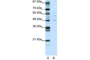 PLAGL1 antibody (20R-1207) used at 0. (PLAGL1 antibody  (N-Term))
