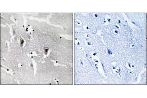 Immunohistochemistry analysis of paraffin-embedded human brain tissue, using RBM6 Antibody. (RBM6 antibody  (AA 991-1040))