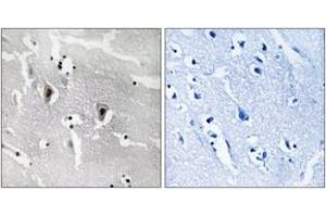 Immunohistochemistry analysis of paraffin-embedded human brain tissue, using RBM6 Antibody.