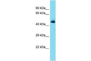 Host: Rabbit Target Name: SERPINA11 Sample Type: Fetal Heart lysates Antibody Dilution: 1. (SERPINA11 antibody  (Middle Region))