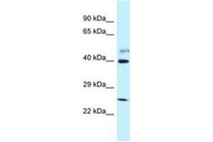 Image no. 1 for anti-Glutamate Receptor, Ionotropic, N-Methyl D-Aspartate-Like 1A (GRINL1A) (AA 283-332) antibody (ABIN6747701) (POLR2M antibody  (AA 283-332))