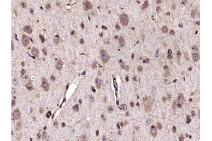 Paraformaldehyde-fixed, paraffin embedded Rat brain Antigen retrieval by boiling in sodium citrate buffer (pH6. (TRKA antibody  (AA 101-200))