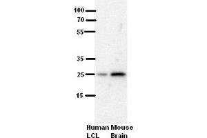 WB Suggested Anti-SH3BGR Antibody Blocking:  5% Milk  Antibody dilution:  1:500  Positive Control:  human LCL and mouse brains (SH3BGR antibody  (N-Term))