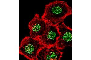 Fluorescent confocal image of A431 cell stained with HOMEZ Antibody (N-term) (ABIN654727 and ABIN2844415). (HOMEZ antibody  (N-Term))