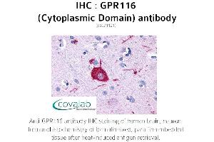 Image no. 1 for anti-G Protein-Coupled Receptor 116 (GPR116) (3rd Cytoplasmic Domain) antibody (ABIN1734907)