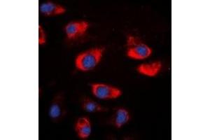 Immunofluorescent analysis of Cystatin A staining in A549 cells. (CSTA antibody)
