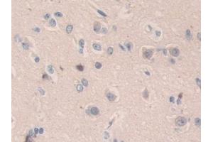 Detection of SMC3 in Human Cerebrum Tissue using Polyclonal Antibody to Structural Maintenance Of Chromosomes Protein 3 (SMC3) (SMC3 antibody  (AA 994-1181))