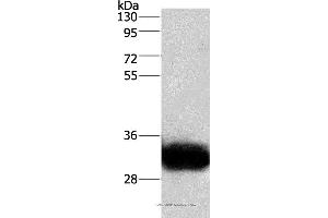 Western blot analysis of Human fetal brain tissue, using GPM6A Polyclonal Antibody at dilution of 1:950 (GPM6A antibody)