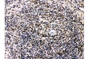 IHC analysis of Bik using anti-Bik antibody (ABIN3043509). (BIK antibody  (AA 1-123))