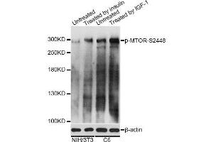 Western blot analysis of extracts of NIH/3T3 and C6 cells, using Phospho-MTOR-S2448 antibody. (MTOR antibody  (pSer2448))