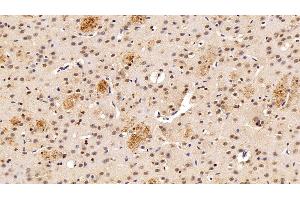 Immunohistochemistry (IHC) image for anti-Transketolase (TKT) (AA 1-294) antibody (ABIN7436402)