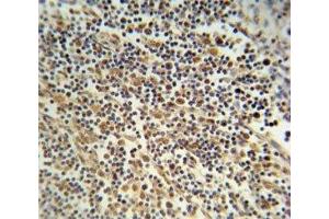 NLRP3 antibody immunohistochemistry analysis in formalin fixed and paraffin embedded human lymph tissue. (NLRP3 antibody  (AA 65-91))
