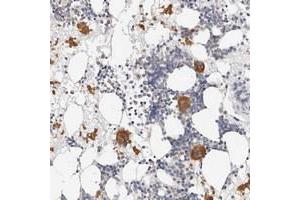 Immunohistochemical staining of human bone marrow with ZRANB1 polyclonal antibody  shows distinct cytoplasmic positivity in bone marrow poietic cells at 1:50-1:200 dilution.