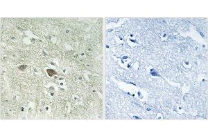 Immunohistochemistry analysis of paraffin-embedded human brain tissue using NDUFV3 antibody. (NDUFV3 antibody)