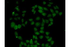 Immunofluorescence analysis of U20S cell using FGF14 antibody.