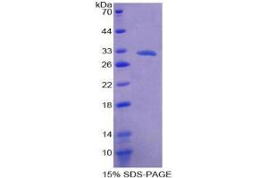 SDS-PAGE (SDS) image for Arachidonate 15-Lipoxygenase B (ALOX15B) (AA 253-490) protein (His tag) (ABIN2124060)
