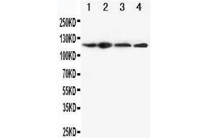 Anti-CIAS1/NALP3 antibody, Western blotting Lane 1: HEP-2 Cell Lysate Lane 2: A549 Cell Lysate Lane 3: U87 Cell Lysate Lane 4: CEM Cell Lysate (NLRP3 antibody  (N-Term))