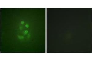 Immunofluorescence analysis of A549 cells, using KIF2C (Phospho-Ser95) Antibody. (KIF2C antibody  (pSer95))