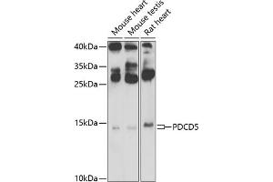 Western blot analysis of extracts of various cell lines, using PDCD5 Antibody (ABIN6132965, ABIN6145338, ABIN6145339 and ABIN6223132) at 1:500 dilution. (PDCD5 antibody  (AA 1-125))
