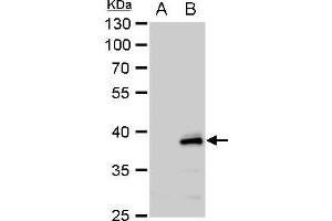WB Image YKL-39 antibody [N1C3] detects YKL-39 protein by western blot analysis.