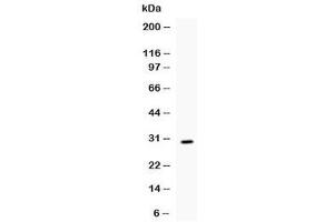 Western blot testing of recombinant mouse IL17 protein (0. (IL-17 antibody  (AA 26-158))