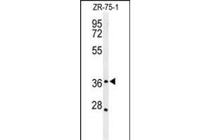 Western blot analysis of MIIP Antibody (C-term) (ABIN651250 and ABIN2840153) in ZR-75-1 cell line lysates (35 μg/lane).
