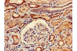 Immunohistochemistry of paraffin-embedded human kidney tissue using ABIN7173996 at dilution of 1:100