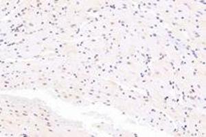 Immunohistochemistry analysis of paraffin-embedded mouse heart using,SRFBP1 (ABIN7075579) at dilution of 1: 2000