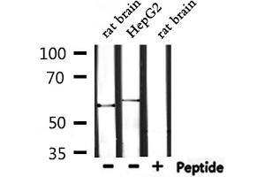 Western blot analysis of extracts from rat brain and HepG2, using TRIO Antibody. (TRIO antibody  (Internal Region))