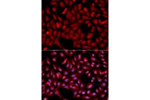 Immunofluorescence (IF) image for anti-E3 Ubiquitin-Protein Ligase SIAH1 (SIAH1) antibody (ABIN1874778)