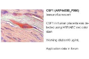 Image no. 2 for anti-Colony Stimulating Factor 1 (Macrophage) (CSF1) (Middle Region) antibody (ABIN2781823) (M-CSF/CSF1 antibody  (Middle Region))