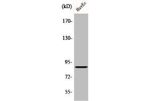 Western Blot analysis of HuvEc cells using cGKII Polyclonal Antibody (PRKG2 antibody  (Internal Region))