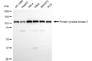Western blotting analysis using protein tyrosine kinase 2 antibody (ABIN7800062). (Recombinant FAK antibody)