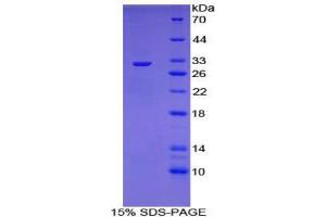 SDS-PAGE (SDS) image for Cytochrome P450, Family 21, Subfamily A, Polypeptide 2 (CYP21A2) (AA 37-264) protein (His tag) (ABIN2124565)