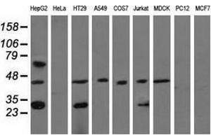 Western blot analysis of extracts (35 µg) from 9 different cell lines by using anti-QPRT monoclonal antibody. (QPRT antibody)