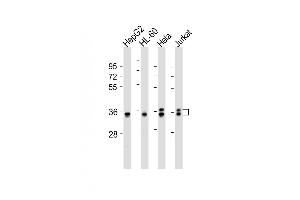 All lanes : Anti-AKR7L Antibody (Center) at 1:2000 dilution Lane 1: HepG2 whole cell lysates Lane 2: HL-60 whole cell lysates Lane 3: Hela whole cell lysates Lane 4: Jurkat whole cell lysates Lysates/proteins at 20 μg per lane. (AKR7L antibody  (AA 207-237))