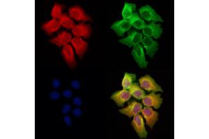 ABIN6258102 and ABIN6273682 staining Hela cells by IF/ICC. (Keratin 36 antibody  (Internal Region))