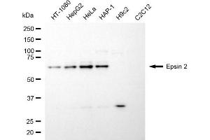 Western blotting analysis using epsin 2 antibody (ABIN7798489). (Epsin 2 antibody)