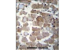 CTSK Antibody (Center ) (ABIN656812 and ABIN2846026) immunohistochemistry analysis in formalin fixed and paraffin embedded human skeletal muscle followed by peroxidase conjugation of the secondary antibody and DAB staining.