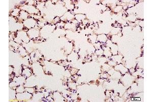 Formalin-fixed and paraffin embedded rat lung labeled with Anti KLK6 Polyclonal Antibody,Unconjugated (ABIN759101) at 1:200 followed by conjugation to the secondary antibody and DAB staining.