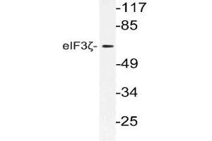 Western blot analysis using eIF3D antibody in extracts from 3T3 cells. (EIF3D antibody)