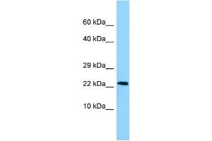 WB Suggested Anti-NDUFAF2 Antibody Titration: 1. (NDUFAF2 antibody  (N-Term))
